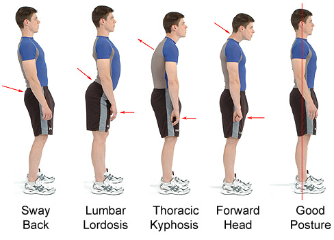 The Ultimate Guide to Good Posture (Infographic)