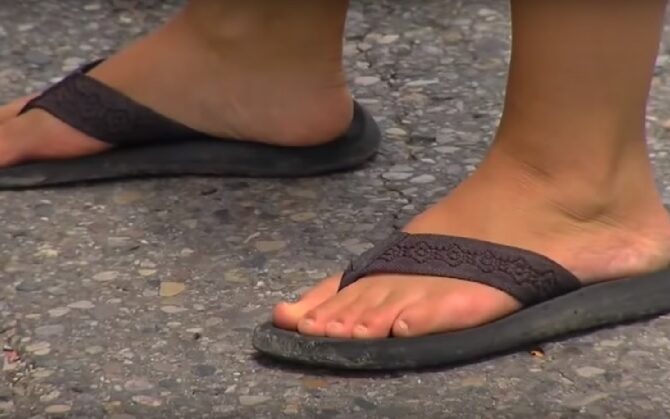 Doctors Warn: Don’t Wear Flip Flops For THIS Dangerous Reason!